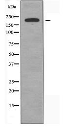 SCN4A Antibody