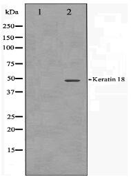 Keratin 18 Antibody