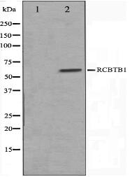 RCBTB1 Antibody