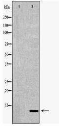 S100B Antibody