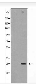 RAMP2 Antibody
