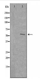 WASF3 Antibody