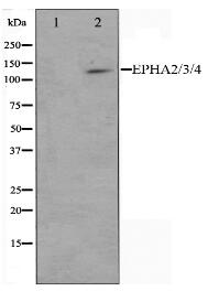 EPHA2/3/4 Antibody