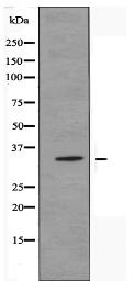 OR2T11 Antibody