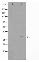 MRRF Antibody