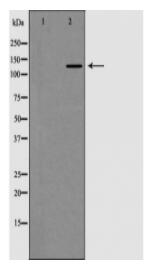 Collagen III Antibody