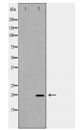 IGF2 Antibody