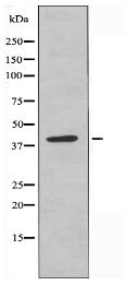 TSTA3 Antibody