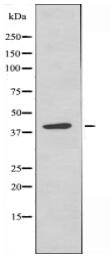 MRPS9 Antibody