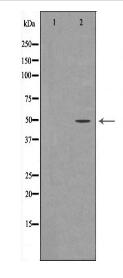 STK11 Antibody