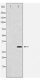 IL2RA Antibody