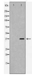 PPP1CA Antibody