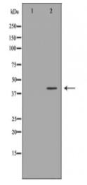 KRT19 Antibody