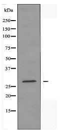 RPS4Y1 Antibody