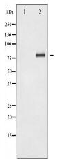 Acetyl-NF-kappaB p65 (Lys310) Antibody