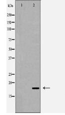 Caspase 6 (Cleaved-Asp179) Antibody