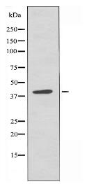RAD51L3 Antibody