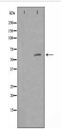 ZNF329 Antibody