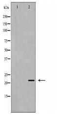 IGF1 Antibody