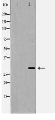 Bag 1 Antibody