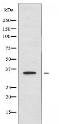 PPP1R3C Antibody