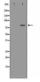 TGM2 Antibody