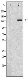 ITGAV Antibody