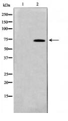 NF-κB p65 Antibody