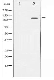 Amyloid beta A4 Antibody