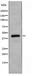 SUV39H2 Antibody