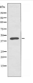 PHKG1 Antibody