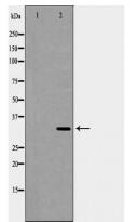 RPLP0 Antibody