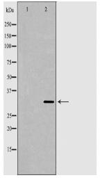 TPM1 Antibody