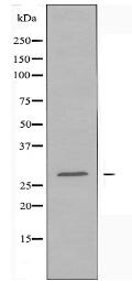 HOXB9 Antibody