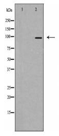 RASA3 Antibody