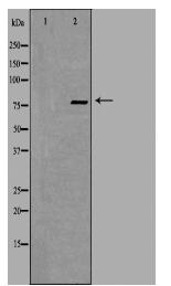 ZNF420 Antibody