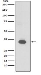 CD20 Antibody