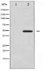 Vitamin D Receptor Antibody