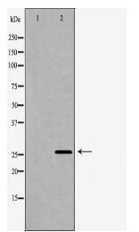 PRL Antibody