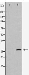 PDGFB Antibody