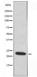 MRPL22 Antibody