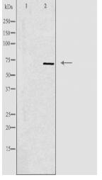 S6K Antibody