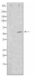 TF2H1 Antibody