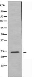 LYPLA1 Antibody