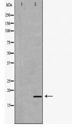 IL17A Antibody