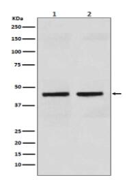 Cytokeratin 18 Antibody