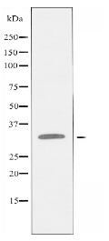 PITX1 Antibody