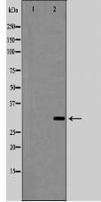 Interleukin 1β Antibody