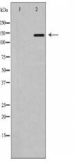 P Glycoprotein 1（MDR1） Antibody