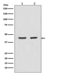 Actin (Alpha-Actin) Antibody